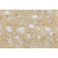 Staron PG840 Pebble Gold Worktop Accessories